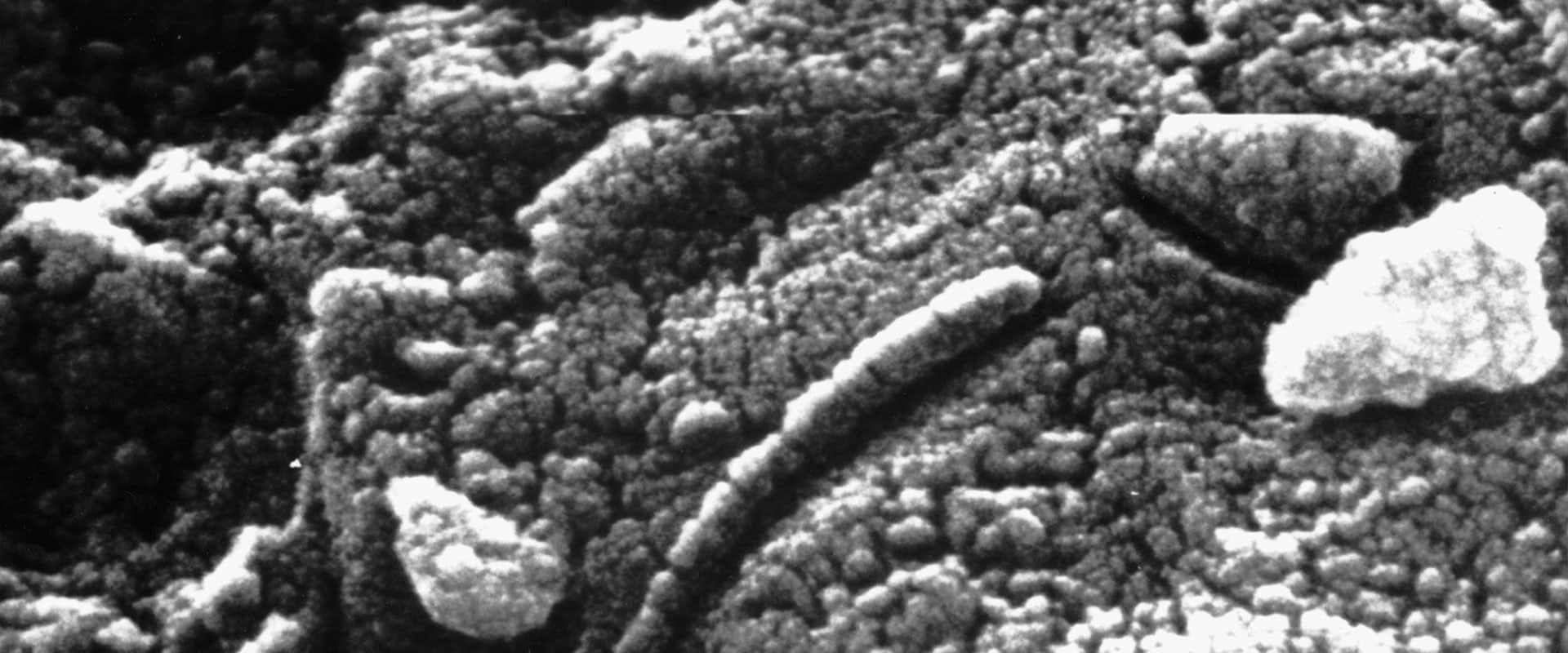 The Discovery of Microbial Fossils on Mars: Uncovering Evidence of Extraterrestrial Life